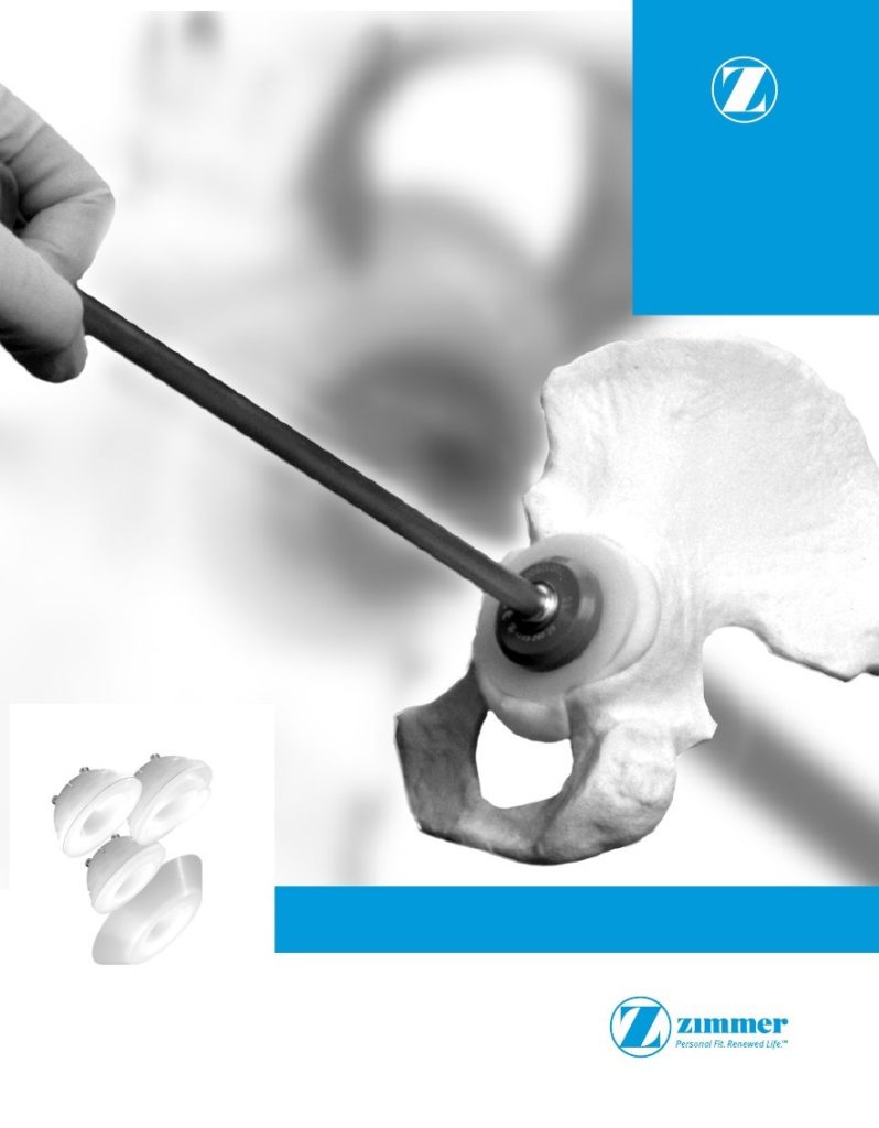 Artroplastia primara de sold – Componente acetabulare cimentate – ZCA® All-Poly
